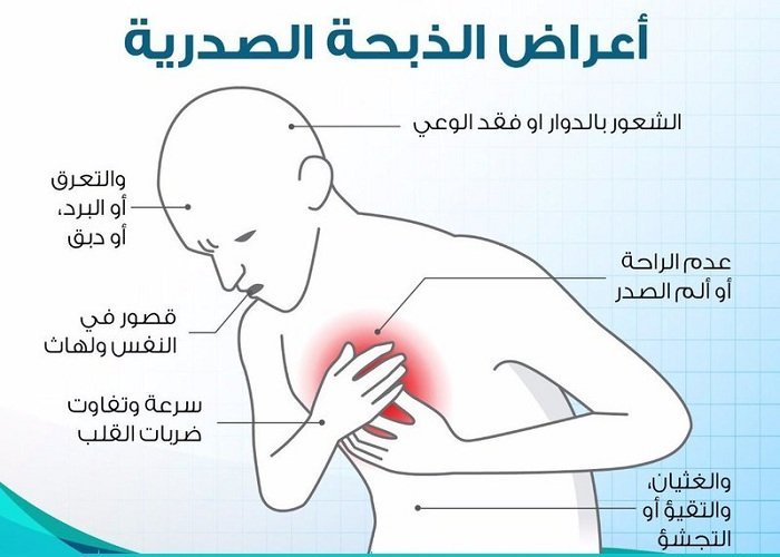 أعراض الذبحة الصدرية والوقاية منها